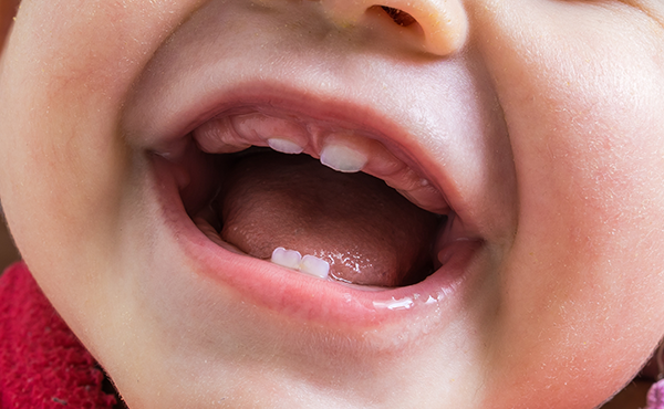 赤ちゃんの口の中にはムシバ菌はいません。この細菌はもともと人間の口の中にいるものではないのです。では一体ムシバ菌(ミュータンス菌)はいつ口の中に入ってくるのでしょうか？