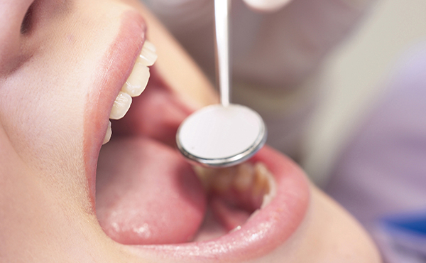 歯周病の定期健診