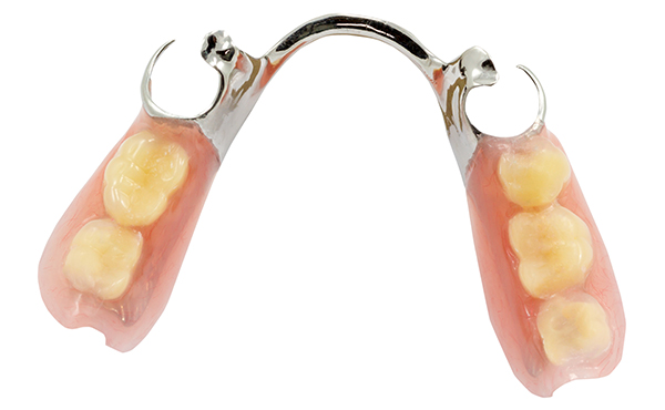 入れ歯の材質、デザインや治療技術も進歩していると思います。最近の入れ歯の特色はどんな点ですか？