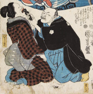 Illustration: How a tooth was extracted painted by Kuniyoshi Utagawa