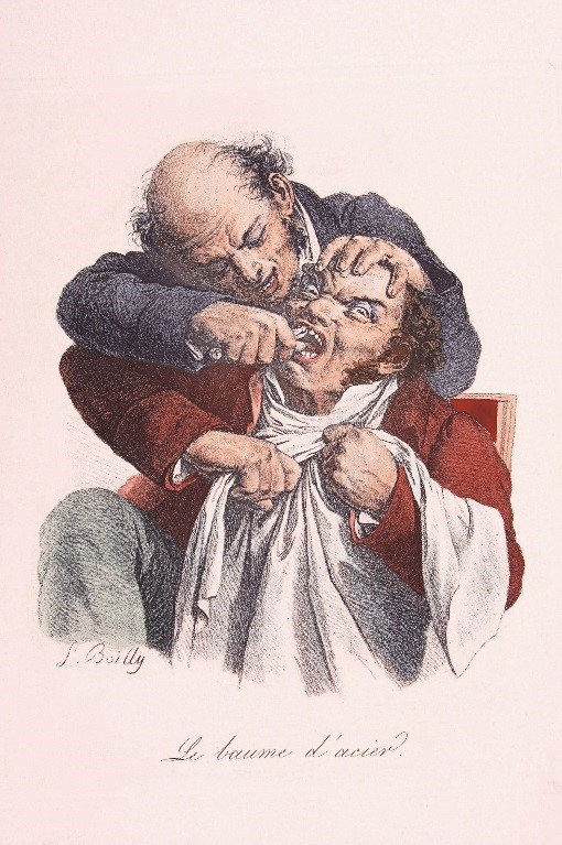 Illustration: Extraction by barber-surgeon