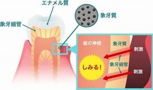 歯がしみる 原因と対処法 公益社団法人神奈川県歯科医師会 歯がしみる 原因と対処法 公益社団法人神奈川県歯科医師会