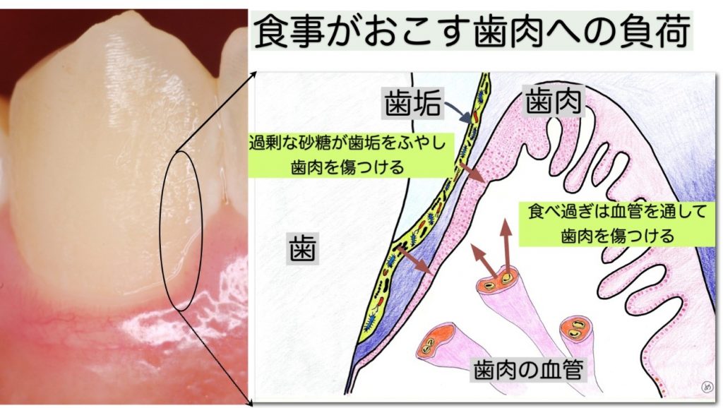 食べ 過ぎ た 甘い もの 要注意！「糖分摂り過ぎ」の6つのサインを栄養士が伝授