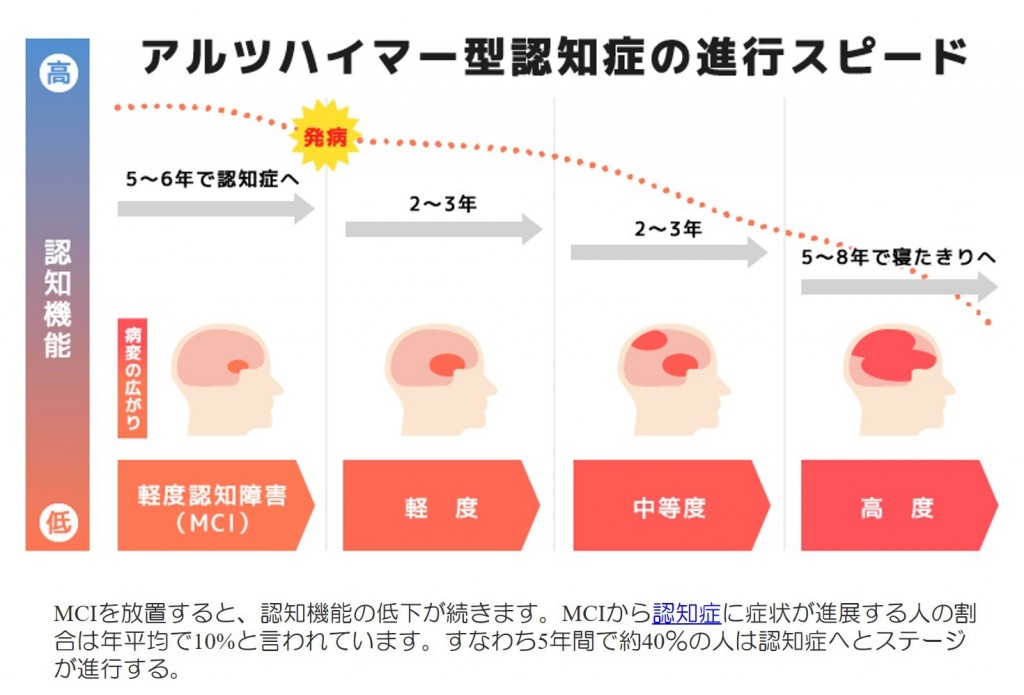 アルツハイマー 型 認知 症 と は